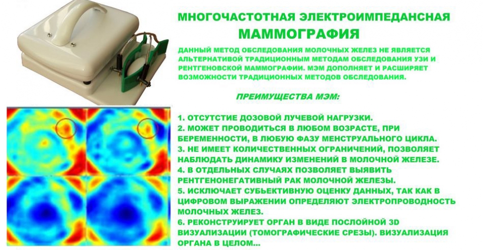 Маммография: показания, когда лучше делать?